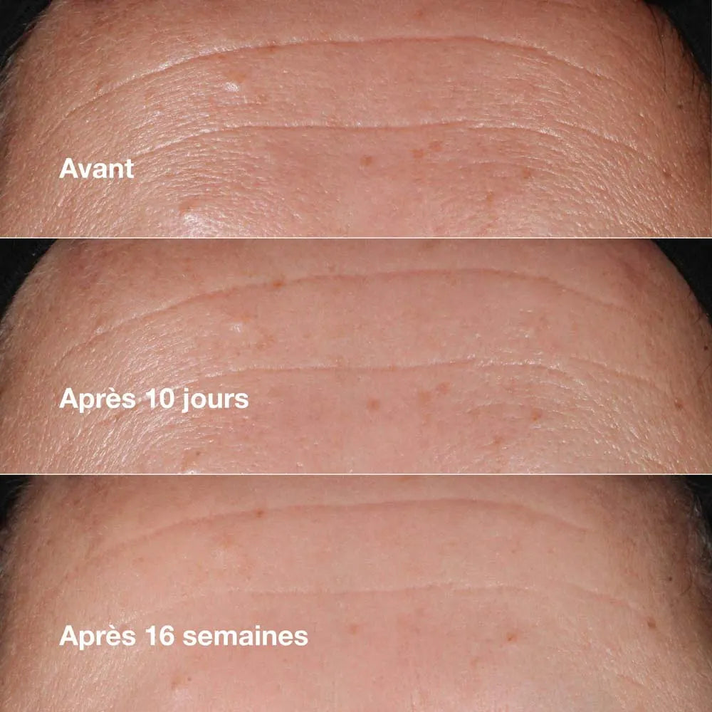 CLINIQUE SMART CLINICAL REPAIR Sérum Correcteur Anti-rides - 30ml
