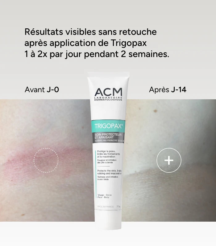 ACM TRIGOPAX Soin Protecteur Apaisant - 75g