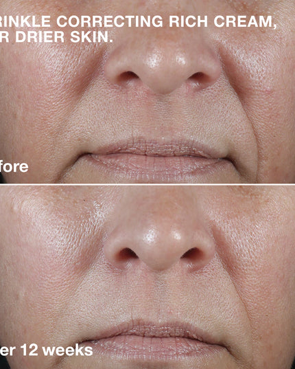 CLINIQUE SMART CLINICAL REPAIR Crème Correctrice Anti-Rides - 50ml